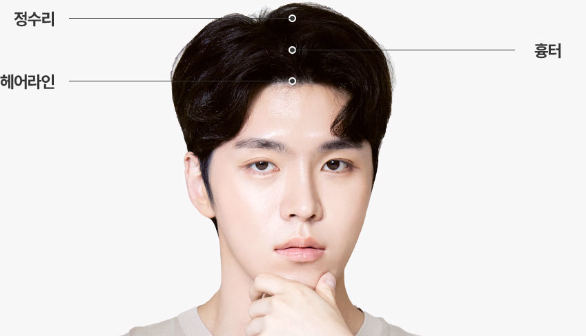 두피문신 적용 범위